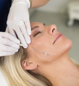 Threads Cog Treatment